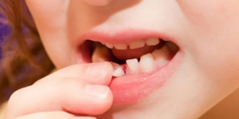 Những con số nào có thể đem lại vận may sau giấc mơ rụng răng?