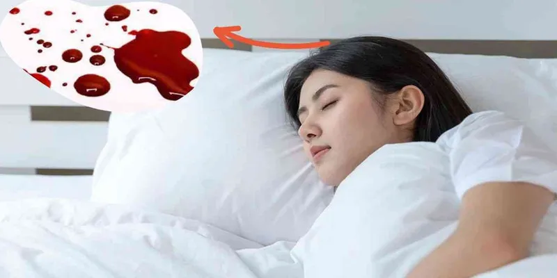 Giải thích hiện tượng nằm mơ thấy máu chảy